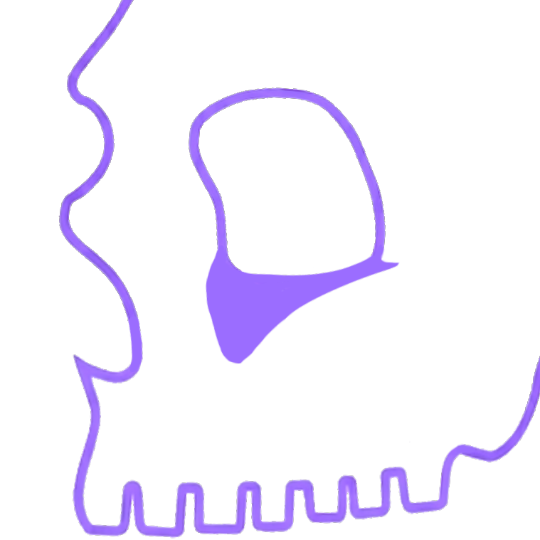 Infraorbital Rim Implants (Pro)